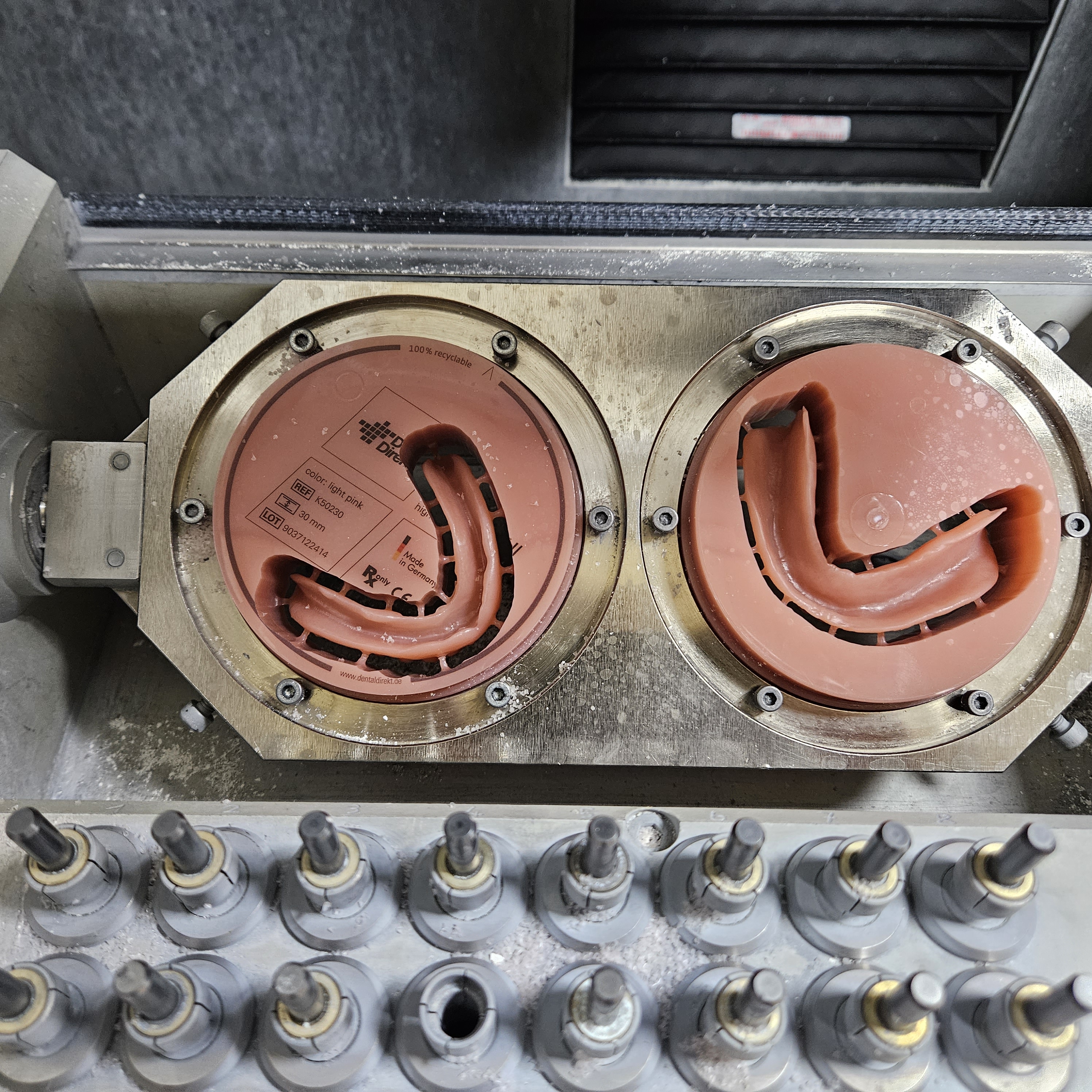 Totalprothetik – individuelle Anpassung